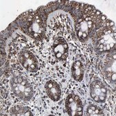 ANTI-HSPA9 antibody produced in rabbit Prestige Antibodies&#174; Powered by Atlas Antibodies, affinity isolated antibody, buffered aqueous glycerol solution