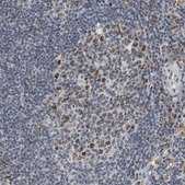 Anti-ELAC2 antibody produced in rabbit Prestige Antibodies&#174; Powered by Atlas Antibodies, affinity isolated antibody, buffered aqueous glycerol solution
