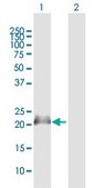 Anti-NPM3 antibody produced in mouse IgG fraction of antiserum, buffered aqueous solution