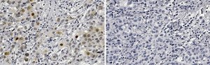 Anti-Phospho-AKT1-(Ser473) Antibody, clone 1O14 ZooMAb&#174; Rabbit Monoclonal recombinant, expressed in HEK 293 cells
