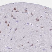 Anti-TMEM35A antibody produced in rabbit Prestige Antibodies&#174; Powered by Atlas Antibodies, affinity isolated antibody, buffered aqueous glycerol solution