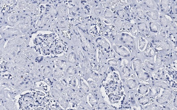 Anti-CD34 Antibody, clone 5C15 , ZooMAb&#174; Rabbit Monoclonal recombinant, expressed in HEK 293 cells