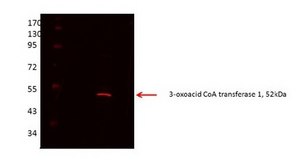 Anti-OXCT1 (AB2) antibody produced in rabbit affinity isolated antibody