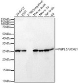 Anti-PGP9.5/UCHL1 Antibody, clone 2Q2S8, Rabbit Monoclonal