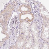 Anti-GSDMC antibody produced in rabbit Prestige Antibodies&#174; Powered by Atlas Antibodies, affinity isolated antibody, buffered aqueous glycerol solution, Ab3