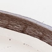 Anti-TGFBI antibody produced in rabbit Prestige Antibodies&#174; Powered by Atlas Antibodies, affinity isolated antibody, buffered aqueous glycerol solution