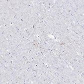 Anti-CARTPT antibody produced in rabbit Prestige Antibodies&#174; Powered by Atlas Antibodies, affinity isolated antibody, buffered aqueous glycerol solution