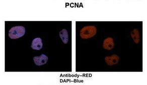 Anti-PCNA IgG fraction of antiserum