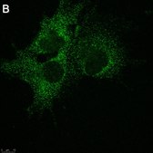 Anti-SLC19A1 Antibody, clone 2E11 ZooMAb&#174; Rabbit Monoclonal recombinant, expressed in HEK 293 cells
