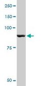 Monoclonal Anti-PYGM antibody produced in mouse clone 2C4, purified immunoglobulin, buffered aqueous solution