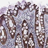 Anti-BCL2L14 antibody produced in rabbit Prestige Antibodies&#174; Powered by Atlas Antibodies, affinity isolated antibody, buffered aqueous glycerol solution