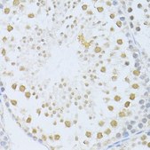 Anti-POLR2A antibody produced in rabbit