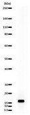 Anti-phospho (Ser10)-acetyl (Lys14)-Histone H3 Antibody Upstate&#174;, from rabbit