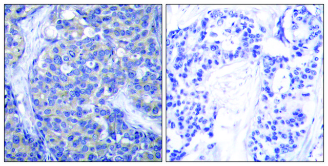 Anti-ZAP-70 antibody produced in rabbit affinity isolated antibody