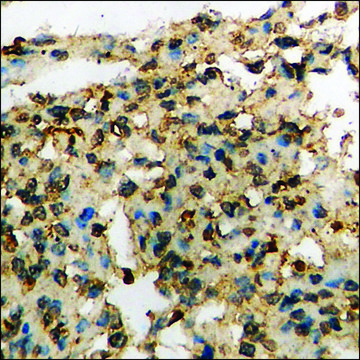 Anti-phospho-EPB41 (pTyr660/418) antibody produced in rabbit affinity isolated antibody