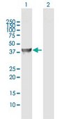 Anti-ADHFE1 antibody produced in rabbit purified immunoglobulin, buffered aqueous solution