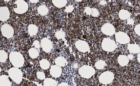 Anti-Iba1/AIF1 Antibody, clone 16B14, ZooMAb&#174; Rabbit Monoclonal recombinant, expressed in HEK 293 cells