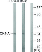 Anti-CKI-&#945; antibody produced in rabbit affinity isolated antibody