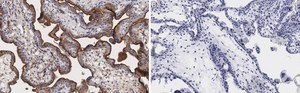 Anti-Integrin &#945;-5 Antibody, clone 5E18 ZooMAb&#174; Rabbit Monoclonal recombinant, expressed in HEK 293 cells