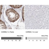 Anti-CARMIL1 antibody produced in rabbit Prestige Antibodies&#174; Powered by Atlas Antibodies, affinity isolated antibody, buffered aqueous glycerol solution, ab1