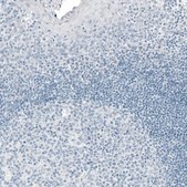 Monoclonal Anti-PRL antibody produced in mouse Prestige Antibodies&#174; Powered by Atlas Antibodies, clone CL6550, purified immunoglobulin, buffered aqueous glycerol solution