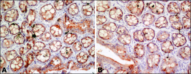 Anti-FUS antibody produced in rabbit ~1.0&#160;mg/mL, affinity isolated antibody
