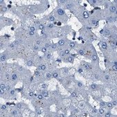 Anti-GSTP1 antibody produced in rabbit Prestige Antibodies&#174; Powered by Atlas Antibodies, affinity isolated antibody, buffered aqueous glycerol solution, Ab1