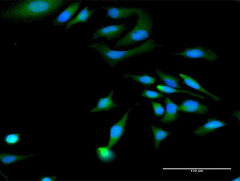 Anti-MAGED1 antibody produced in rabbit purified immunoglobulin, buffered aqueous solution