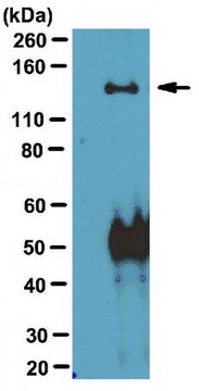 Anti-WASH complex subunit 7 (SWIP) Antibody from rabbit