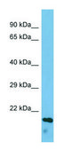 Anti-ECM1 antibody produced in rabbit affinity isolated antibody