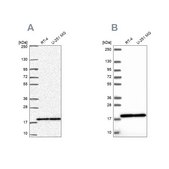 Anti-RPS15 antibody produced in rabbit Prestige Antibodies&#174; Powered by Atlas Antibodies, affinity isolated antibody, buffered aqueous glycerol solution