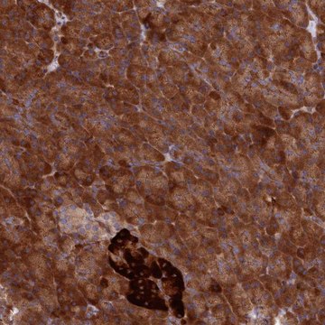 Anti-DDX60L antibody produced in rabbit Prestige Antibodies&#174; Powered by Atlas Antibodies, affinity isolated antibody, buffered aqueous glycerol solution