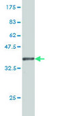 Monoclonal Anti-KIFC1 antibody produced in mouse clone 2B9, purified immunoglobulin, buffered aqueous solution