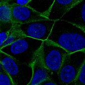 Anti-VANGL1 antibody produced in rabbit Prestige Antibodies&#174; Powered by Atlas Antibodies, affinity isolated antibody, buffered aqueous glycerol solution
