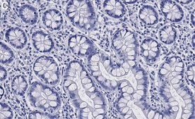 Anti-OAS1 Antibody, clone 1N2 ZooMAb&#174; Rabbit Monoclonal recombinant, expressed in HEK 293 cells