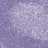 Anti-CCDC39 antibody produced in rabbit Prestige Antibodies&#174; Powered by Atlas Antibodies, affinity isolated antibody, buffered aqueous glycerol solution