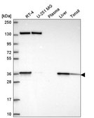 Anti-SC5D antibody produced in rabbit Prestige Antibodies&#174; Powered by Atlas Antibodies, affinity isolated antibody