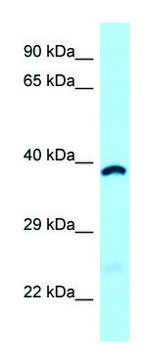 Anti-ABHD6 (C-terminal) antibody produced in rabbit affinity isolated antibody