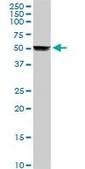 Anti-CYP2A6 antibody produced in rabbit purified immunoglobulin, buffered aqueous solution