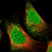 Anti-TNRC18 antibody produced in rabbit Prestige Antibodies&#174; Powered by Atlas Antibodies, affinity isolated antibody, buffered aqueous glycerol solution