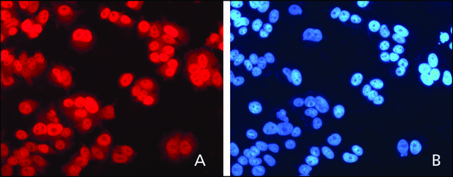 Anti-XPC (C-terminal) antibody produced in rabbit ~1&#160;mg/mL, affinity isolated antibody, buffered aqueous solution