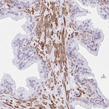 Anti-KCNN4 antibody produced in rabbit Prestige Antibodies&#174; Powered by Atlas Antibodies, affinity isolated antibody, buffered aqueous glycerol solution