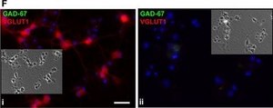 Anti-GAD67 Antibody, clone 1G10.2 clone 1G10.2, Chemicon&#174;, from mouse