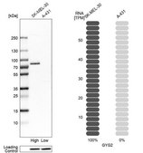 Anti-GYG2 antibody produced in rabbit Prestige Antibodies&#174; Powered by Atlas Antibodies, affinity isolated antibody, buffered aqueous glycerol solution