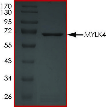 MYLK4, Active PRECISIO&#174; Kinase, recombinant