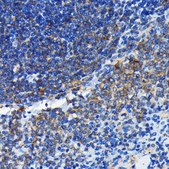 Anti- Bax antibody produced in rabbit