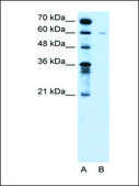 Anti-SLC22A16 antibody produced in rabbit IgG fraction of antiserum