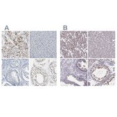 Anti-PKP2 antibody produced in rabbit Prestige Antibodies&#174; Powered by Atlas Antibodies, affinity isolated antibody, buffered aqueous glycerol solution