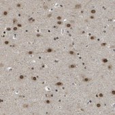 Anti-KAT5 antibody produced in rabbit Prestige Antibodies&#174; Powered by Atlas Antibodies, affinity isolated antibody, buffered aqueous glycerol solution
