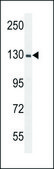 ANTI-RPGR (C-TERM) antibody produced in rabbit IgG fraction of antiserum, buffered aqueous solution